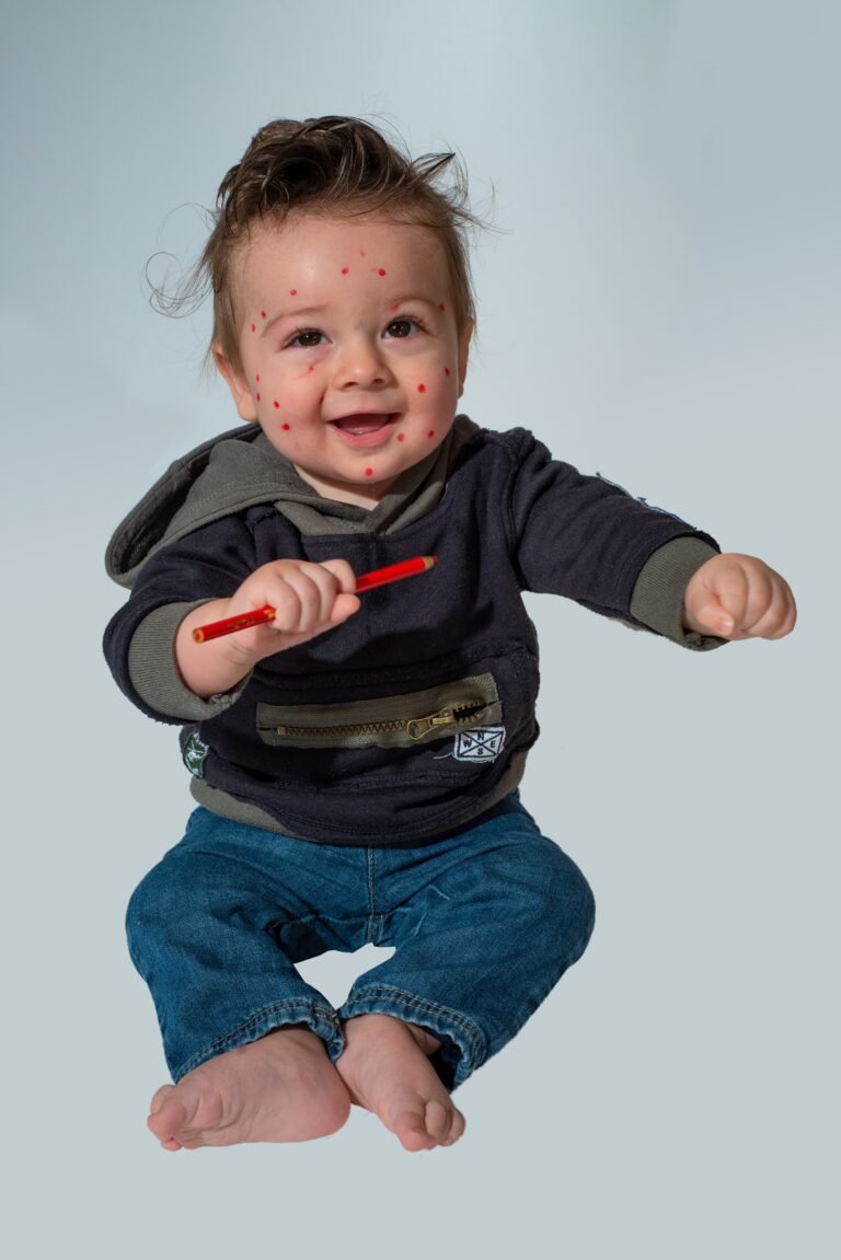 Homeopathy for Chickenpox